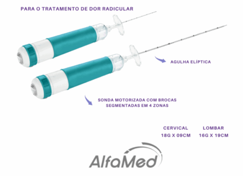 Discetomia percutânea mecanizada com protusão discal.